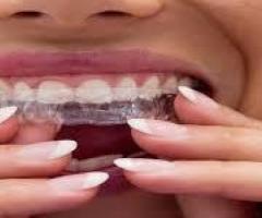 Healthy, natural looking teeth veneers at Dental Concepts - 1