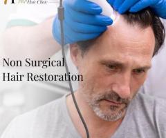 Hair Restoration Fresno Ca