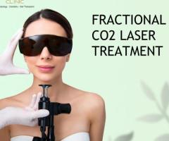 Revitalize Your Skin with Fractional CO2 Laser Treatment