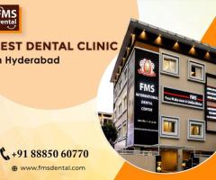 Best Dental Clinic in Hyderabad | FMS Dental