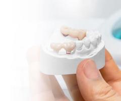 An Overview of Dental Bridges to Replace Missing Teeth