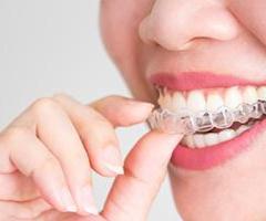 Achieve a Perfect Smile with the Best Invisalign Aligners in Hyderabad