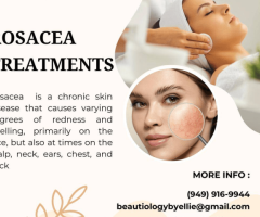 Rosacea Treatments in California, USA