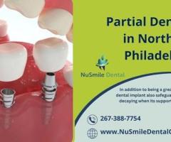 Discover Affordable Partial Dentures at NuSmile Dental Office in Northeast Philadelphia - 1