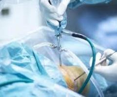 Meet Best Arthroscopy Surgeon in Delhi for Arthroscopic Surgery