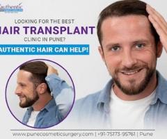 Looking for the Best Hair Transplant Clinic in Pune? Visit Dr. Hitesh Laad - 1