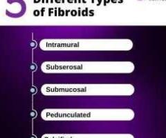 Get Treated for Calcified Fibroids Today!