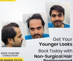 Hair patch in bangalore | Bglam Hair Studio