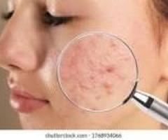 Dr Tanvi Gupta Arora Best Dermatologists in Delhi