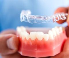 Invisible braces in bangalore | Perfect Smile