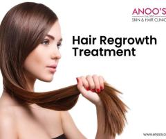 Advanced Hair Regrowth Treatments at Anoos