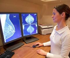 Breast Cancer | Mammography with Best Surgeon | Medanta - 1