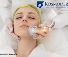 Kosmoderma: Best Skin Lightening and Whitening Treatments in Bangalore