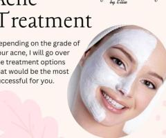 Best Acne Treatment in Los Angeles, CA