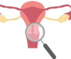 Understanding Intramural Fibroids: Causes, Symptoms, and Treatment Options