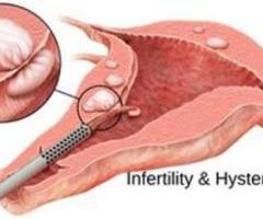 Low-Cost Hysteroscopy Surgery for Reproductive Health Issues | Prem Hospital - 1