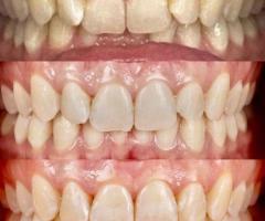 best dental treatment in mumbai