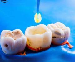 dental treatment in mumbai