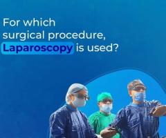 4K 3D Laparoscopy in Ahmedabad