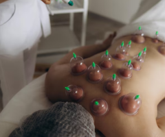 Reap the Benefits of Cupping Therapy in Singapore Today