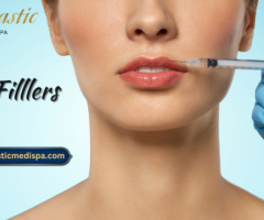 Lip Fillers in Riverside for Smooth Lips - 1