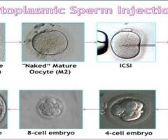 ICSI Treatment Center, ICSI Male Fertility Treatment - Dr. Sudha Tandon's Fertility Center