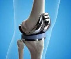 Best Hip Replacement Surgeon In Delhi-Dr. Khera's Wellness Clinic