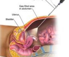 Best IVF, Laparoscopy, Hysteroscopy and Maternity Centre in Mumbai