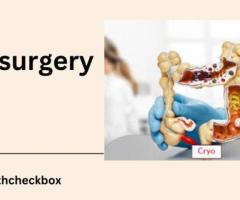 CryosurgeryTreatment