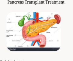 Pancreas Transplant Treatment(Behandlung einer Bauchspeicheldrüsentransplantation