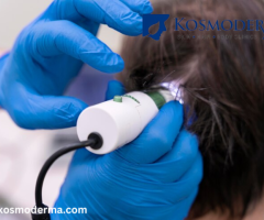 Revitalize Your Hair: Laser Hair Growth Treatment in Bangalore