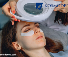 Advanced Laser Treatments for Under Eye Dark Circles and Eye Bags at Kosmoderma in Delhi