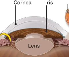 Best Glaucoma Specialist in North Delhi – Dr. Neha Midha, Expert Glaucoma Care in Rohini - 1