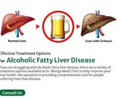 What is the most effective treatment for fatty liver?