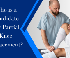 Who Is A Candidate For Partial Knee Replacement? Dr Kundra