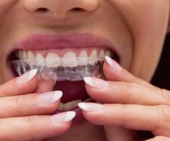 Submit Your Classified Ad | My Corinth Dentist - Invisalign Treatment