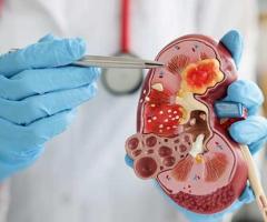 Best Nephrologists In Bangalore - Nephrology Hospitals in Bangalore - 1