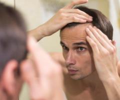 Regain Your Confidence with ISIVI Medicina's Hair Implants for Men