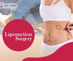 Best Liposuction Surgeon in Hyderabad: Docplus India