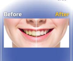 dentures treatment Andover