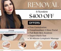 Laser Hair Removal Oakville - 1