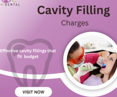 Cavity filling | Quality fillings at fair prices for healthy teeth