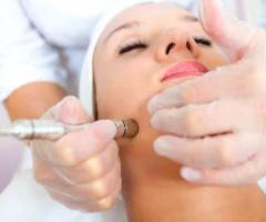 Microdermabrasion Facial in Cloverdale - 1