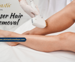 Advanced Laser Hair Removal in Riverside CA