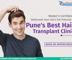 Searching For Hairline Clinic In Pune - Visit Authentic Hair Transplant