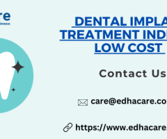 Dental Implant Treatment India At Low Cost | EdhaCare