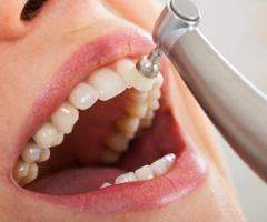 Teeth Cleaning at Whalom Dental