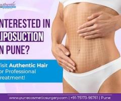 Searching For Top Liposuction Services in Pune - Visit Authentic Cosmetic Centre