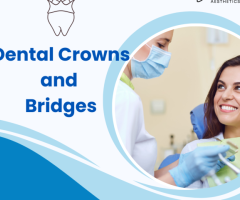 Dental Crowns and Bridges | Zirconia Crowns