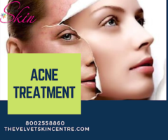 Acne Treatment in Lucknow